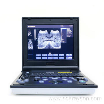 Laptop ultrasound of liver in lion cat